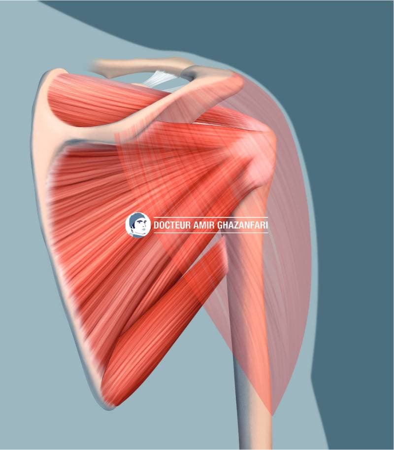 Image 2 Rupture de la coiffe des rotateurs - Figure 1. Muscle de la coiffe des rotateurs et muscle deltoïde