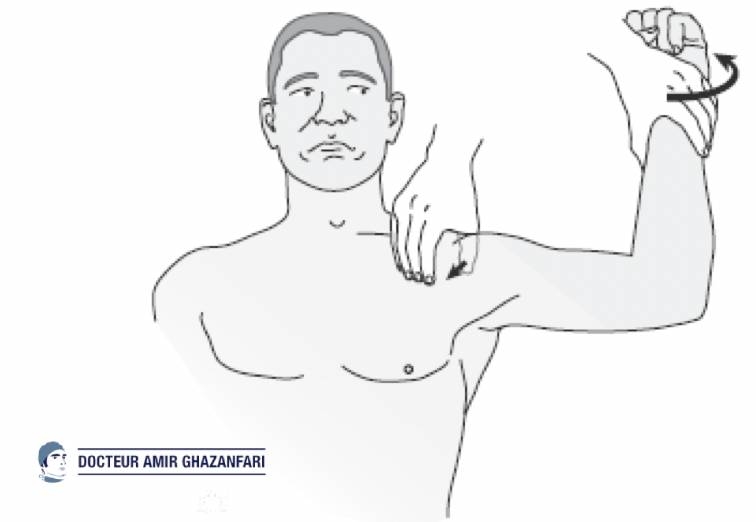 Instabilité antérieure de l'épaule - Figure 4. Test d'appréhension ou position de l'armée du bras permettant d'objectiver une instabilité antérieure de l'épaule