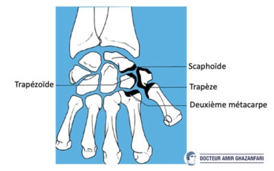 Arthrose du pouce - Figure 1. Rapports anatomiques du trapèze.